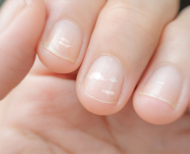 iron deficiency beauty inside