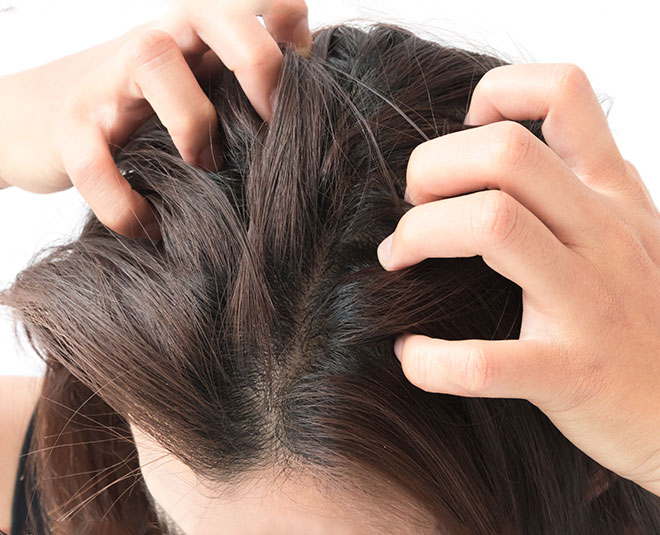 lice remedies inside x