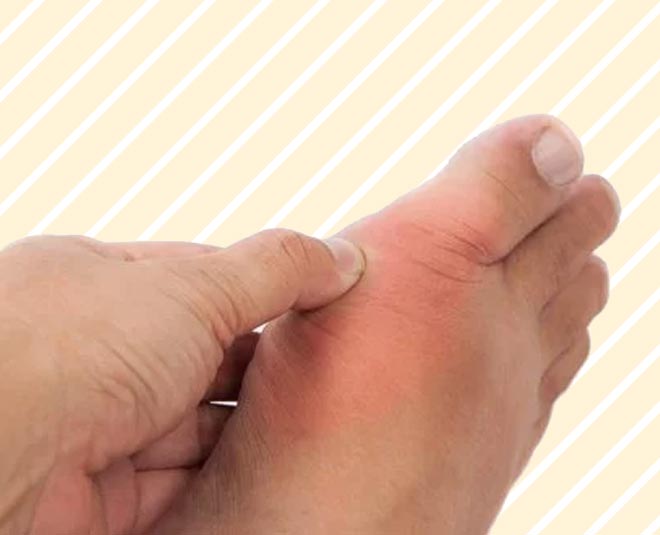 these easy home remedies to reduce uric acid inside