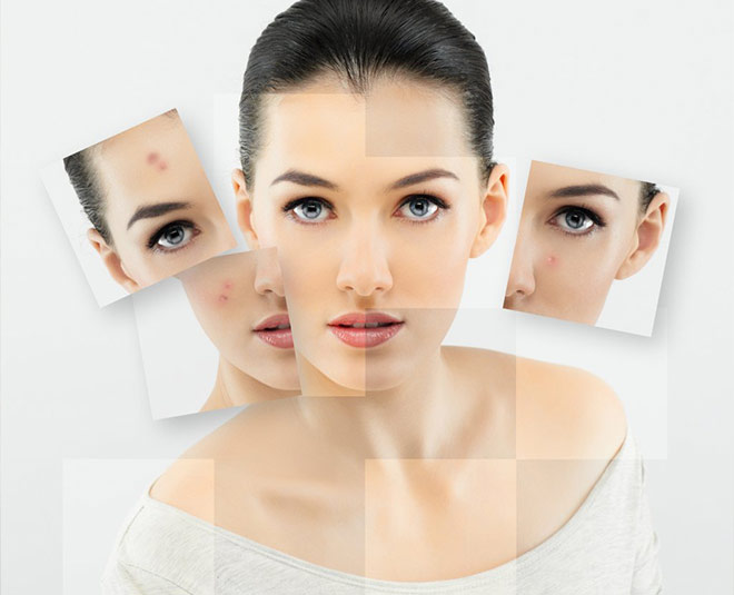 Expert talks about clove oil benefits for hair and skin beauty