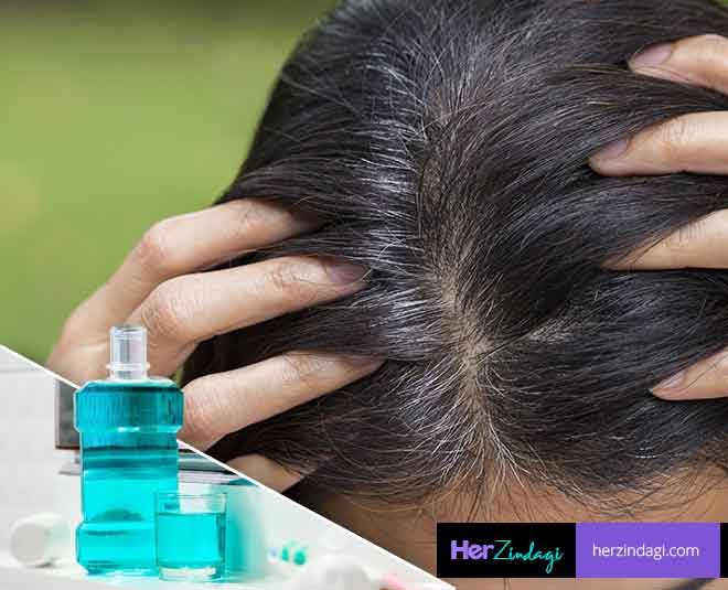 home remedies dandruff mouthwash