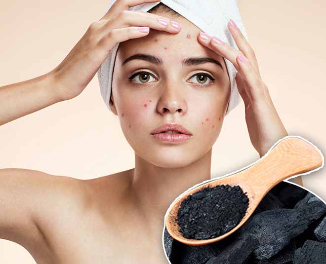 Charcoal beauty benefits acne