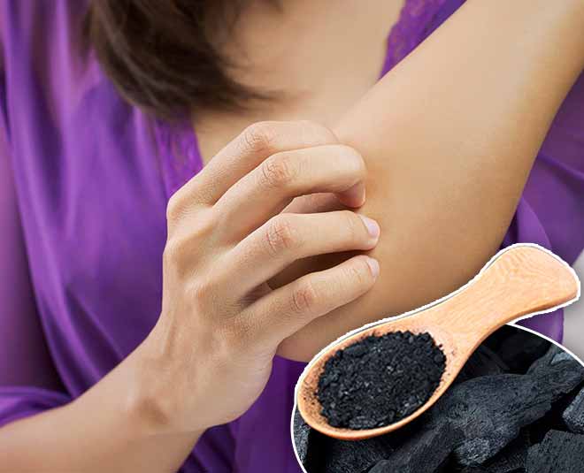 Charcoal beauty benefits insect bites