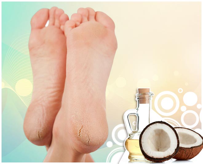 Cocnut oil skin benefits crack heels