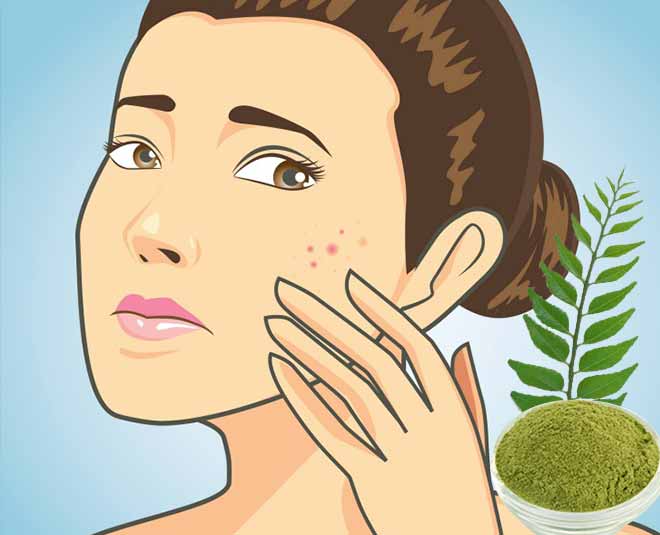 Curry leaves skin hair benefits pimples