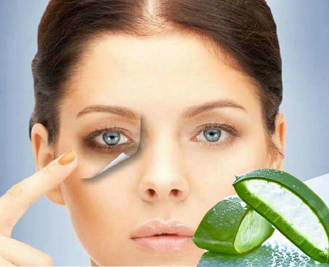 Dark circles home remedy aloe vera