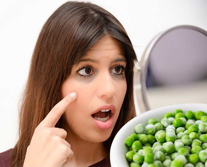 Dark circles home remedy frozen peas