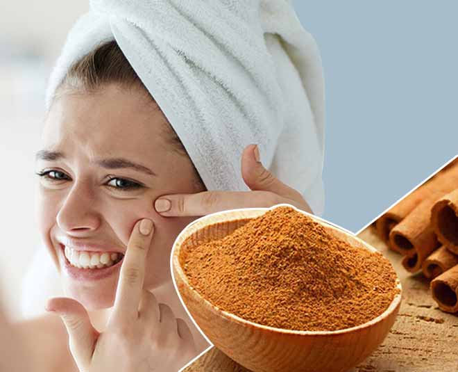 cinnamon beauty benefits insid