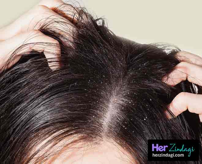 hair wash mouth freshner kills dandruff