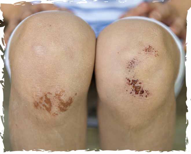 joint pain health inside ()