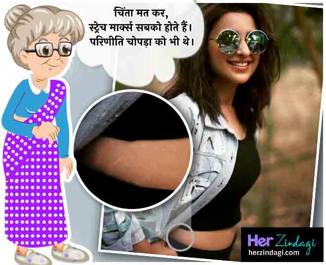 coffee and cocoa butter for stretch marks inside