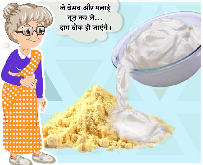 use besan on face to get rid of chickenpox spots in