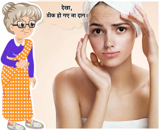 use besan on face to get rid of chickenpox spots in