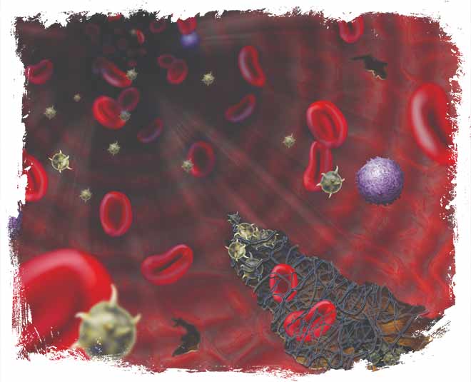 bruises on body reasonsa