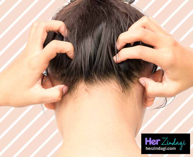 your hair beauty rules bad scalp