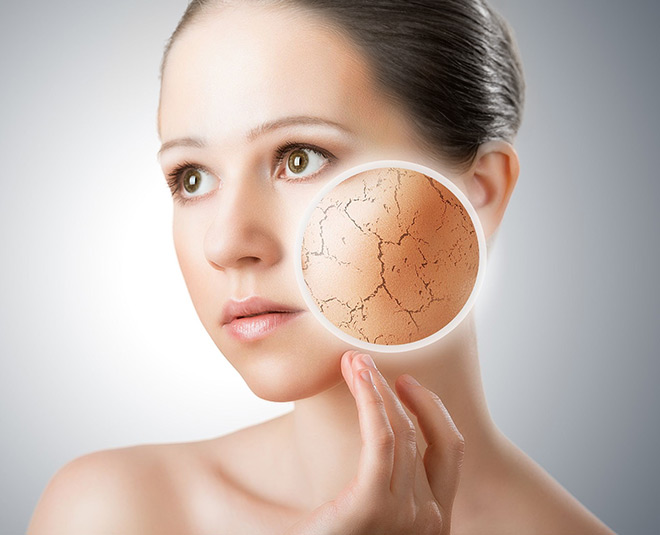 Expert talks about right moisturizer for different skin type