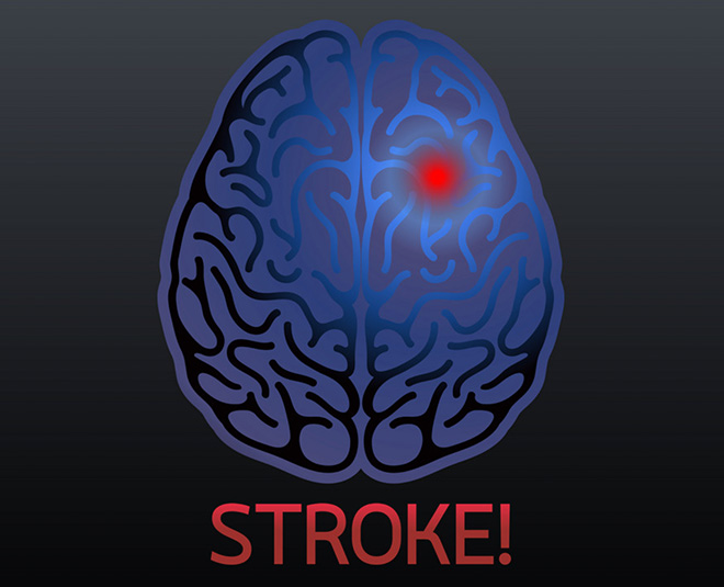 brain stroke health inside