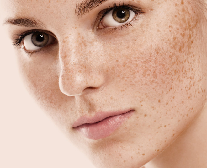 aloe vera for pigmentation card ()