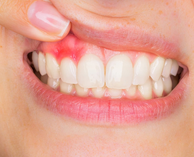 gums problem health card ()