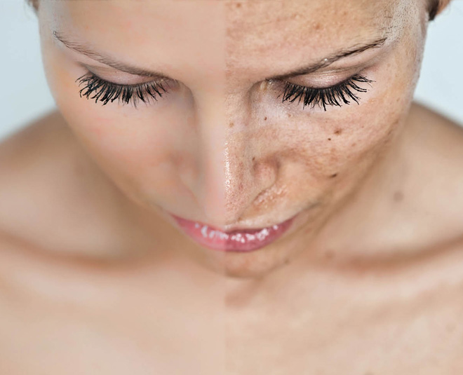 quinoa for skin dark spots