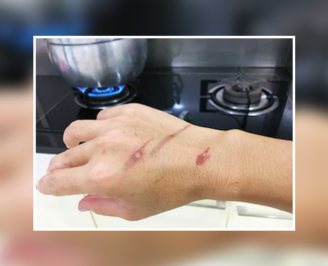 kitchen and burned in inside