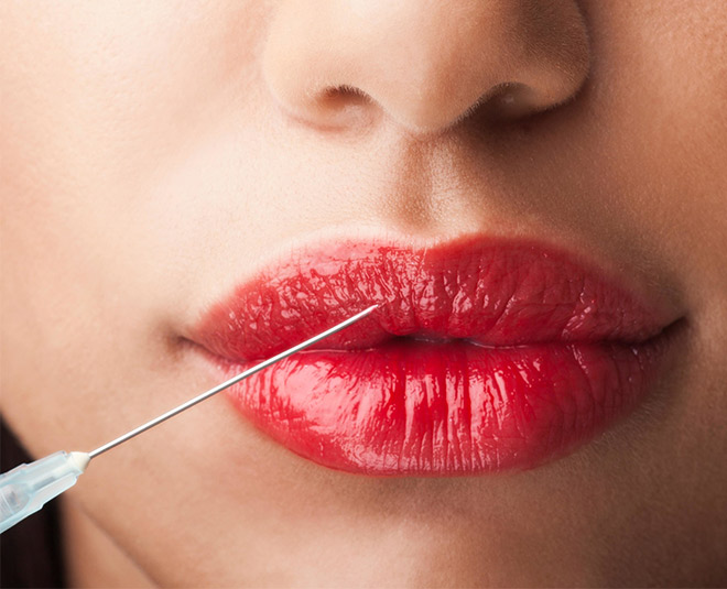 lip fillers surgery women process effects inside
