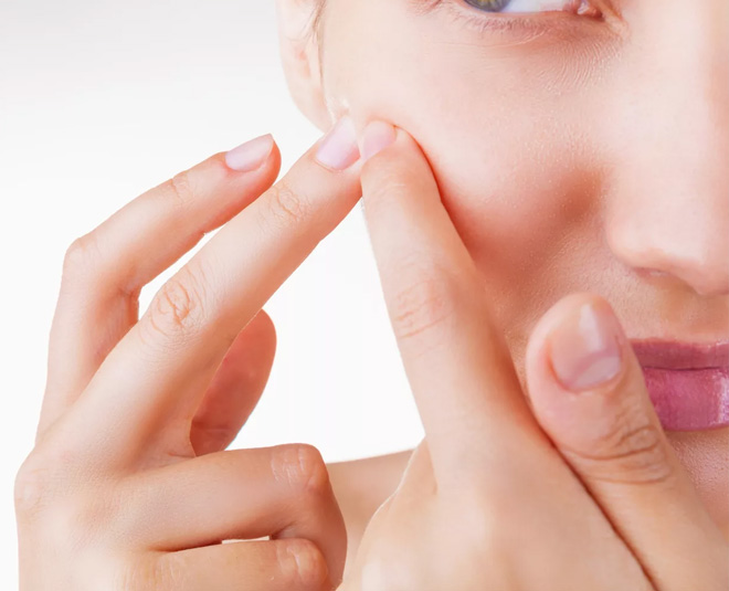 pimple problem remedy INSIDE