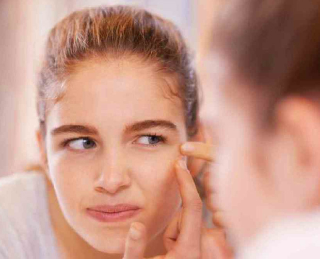 calamine lotion skin care benefits for pimples inside