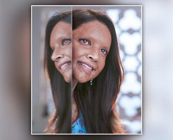 deepika padukone first look chhapaak