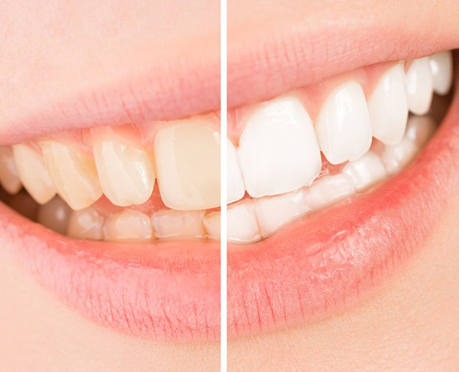 exam stress causes dental probelms thum ()