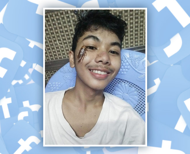 cockroach challenge face