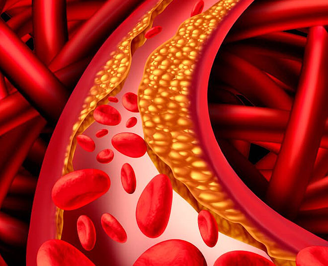 coriander seeds health benefits