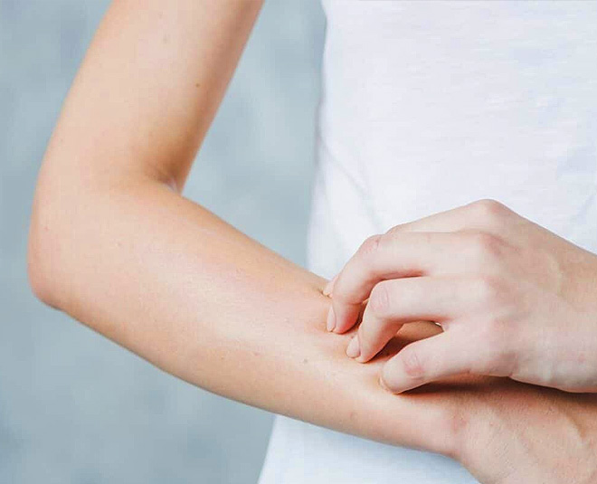 homemade Anti Itch Spray