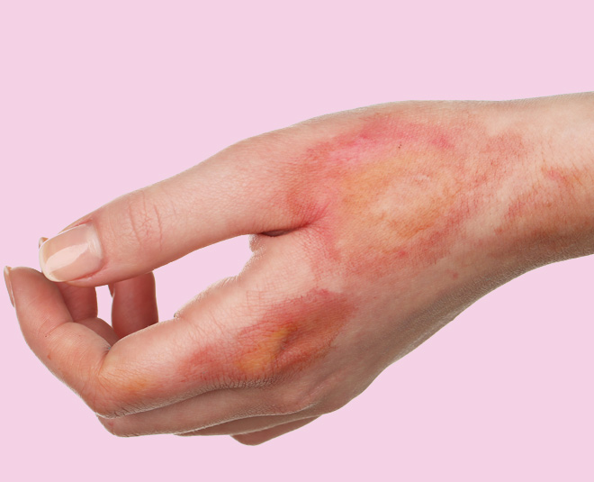 red sandalwood burning