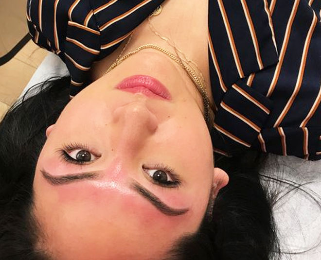 advantages and disadvantages of laser hair removal inside three