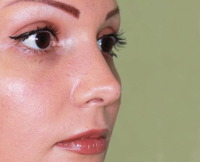know benefits and side effects of rhinoplasty inside two