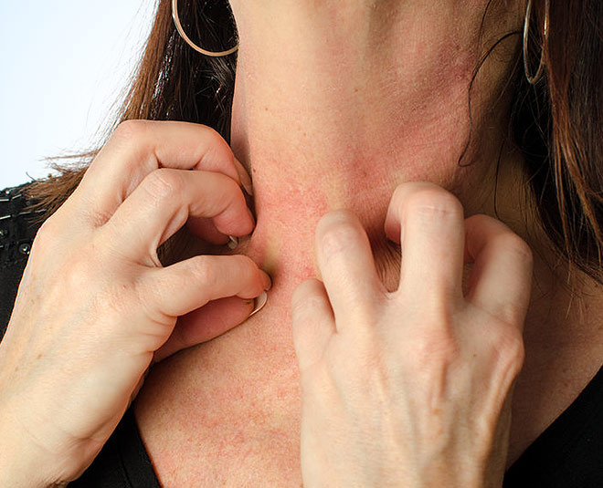 poppy seeds for inflammation