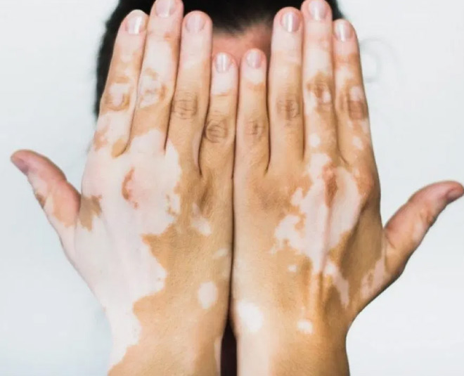 white spots natural tips inside