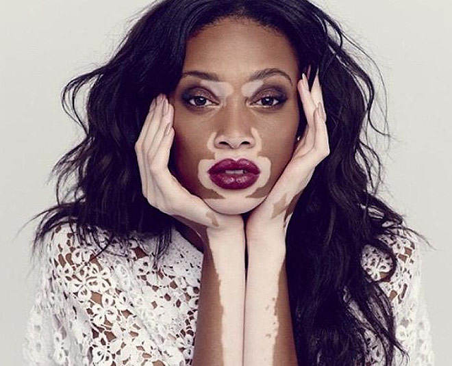 white spots natural tips inside