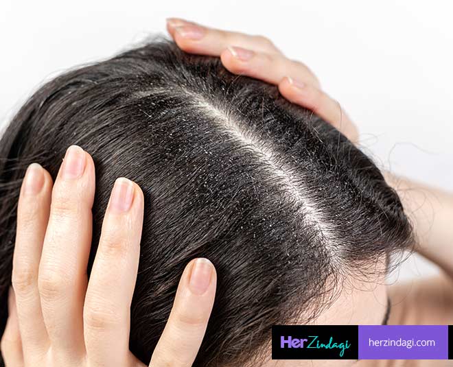 jawed habib dandruff and tips