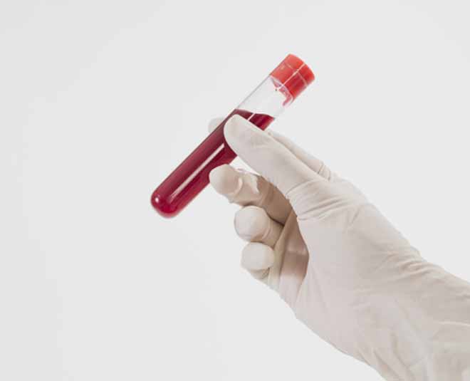 how to get health checkup and test amidst the danger of covid inside