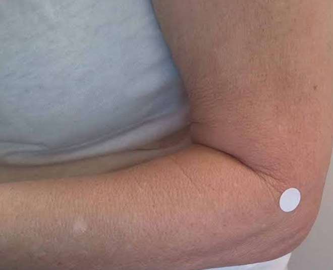 Large intestine point no inside