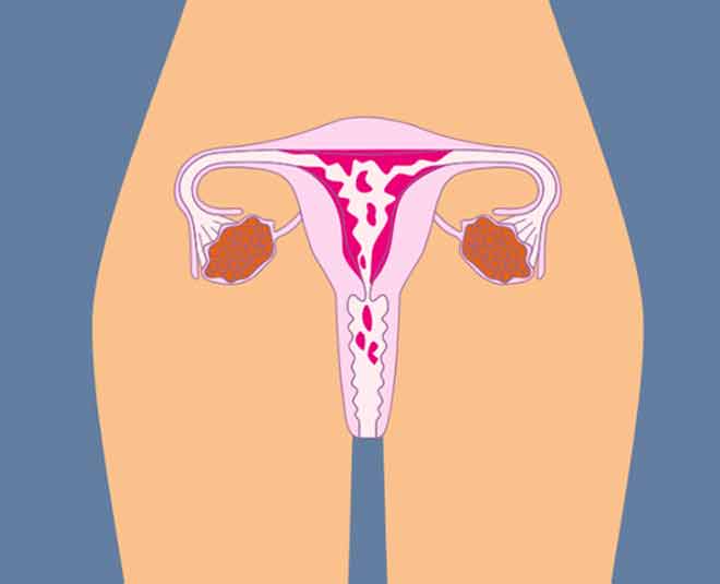 bleeding after enopause