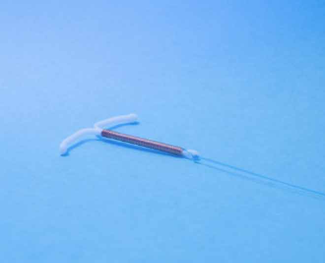 iud birth control inside