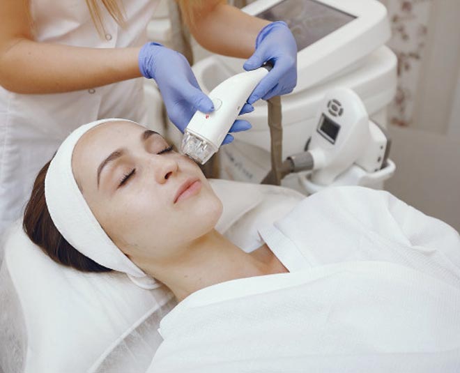 laser for pigmentation around mouth inside