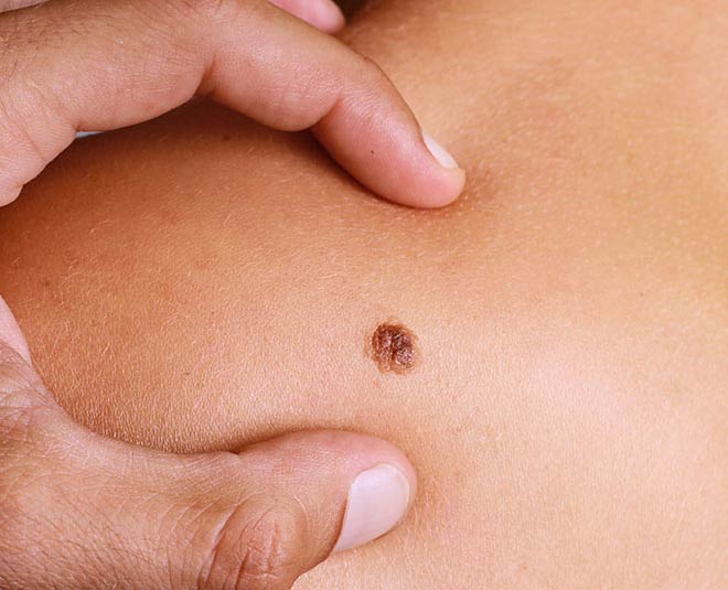 problems occur in skin due to smoking inside