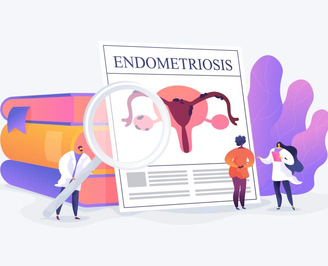 endometriosis treatment