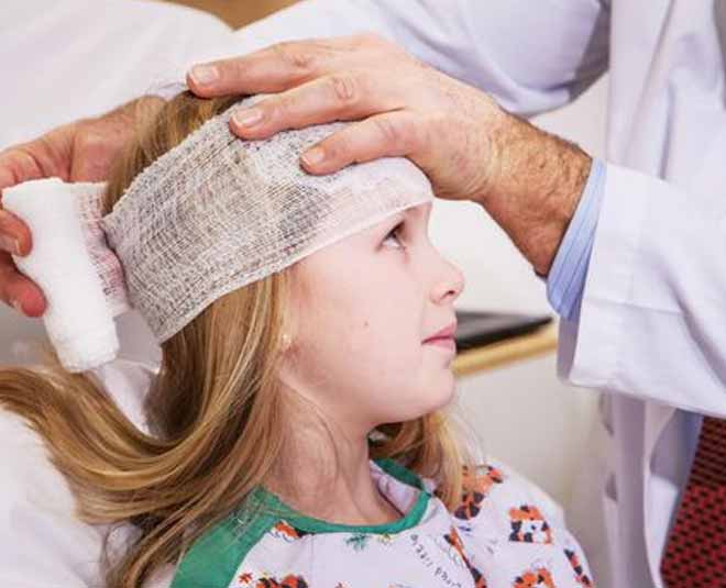 mind durning head injury inside