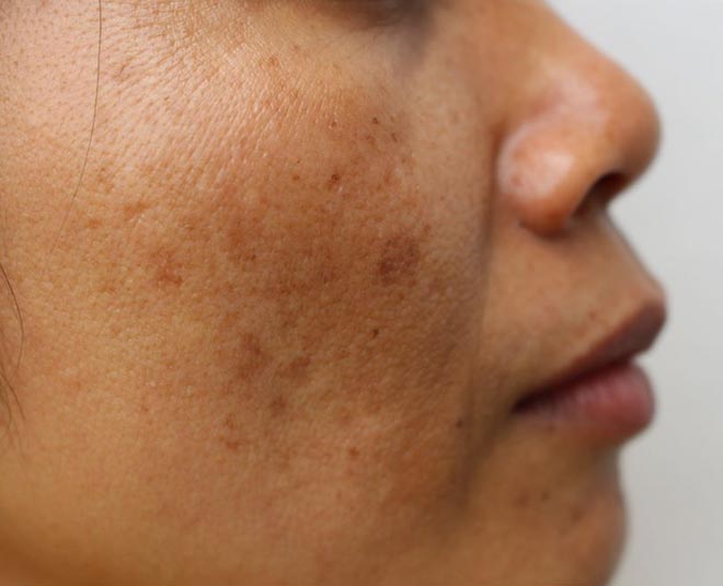 dull skin tips