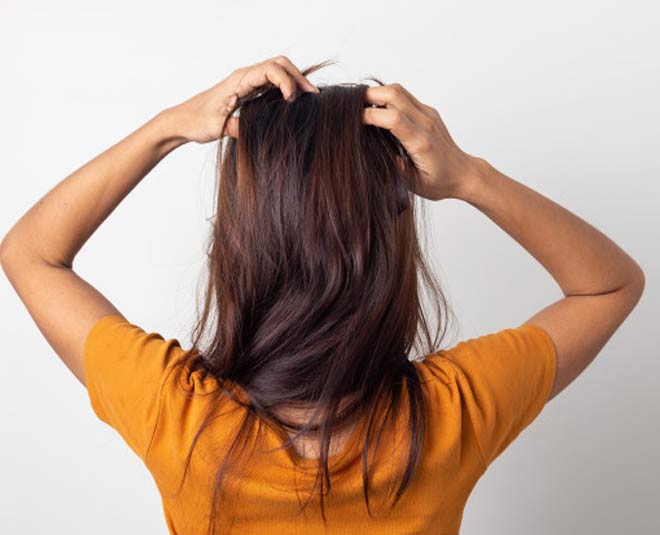 flaky scalp